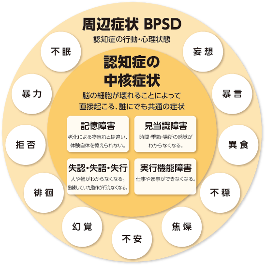 症状 認知 アルツハイマー 型 症